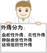 外痔种类